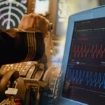 Why Are the EKGs of Pilots No Longer Normal?