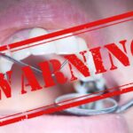 FDA Finally Issues Amalgam Warning