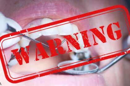 FDA Finally Issues Amalgam Warning