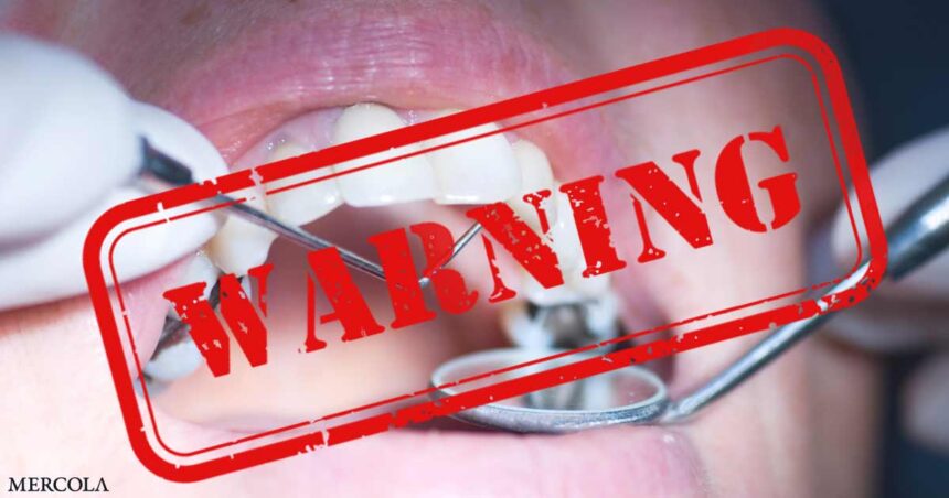 FDA Finally Issues Amalgam Warning