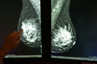 Researchers Identify Possible New Risk for Breast Cancer