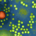 Studies Link Common Childhood Viruses to Rare Hepatitis Cases