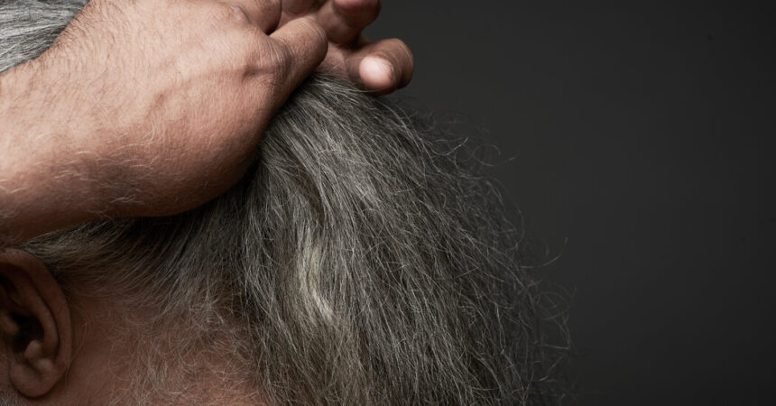 Your Hair Is Going Gray. This Glitch May Explain Why.