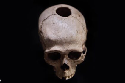 Harmless and Effective Lobotomies: A History Lesson