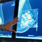 New Mammogram Advice: What to Know