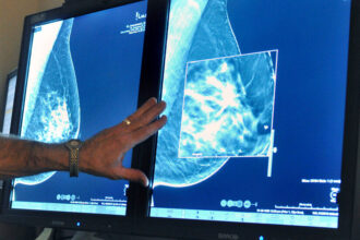 New Mammogram Advice: What to Know