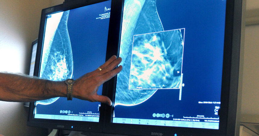 New Mammogram Advice: What to Know