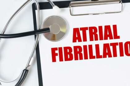 How to Identify Atrial Fibrillation and What Might Help