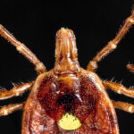 A Half-Million Americans May Have Tick-Linked Meat Allergy, C.D.C. Says