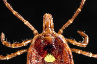 A Half-Million Americans May Have Tick-Linked Meat Allergy, C.D.C. Says