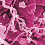 Antibiotic Shortage Could Fuel Rise in Syphilis Rates