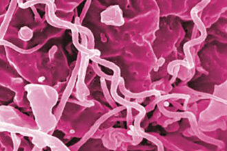 Antibiotic Shortage Could Fuel Rise in Syphilis Rates