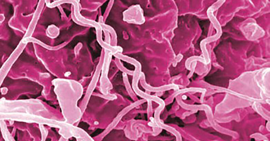 Antibiotic Shortage Could Fuel Rise in Syphilis Rates