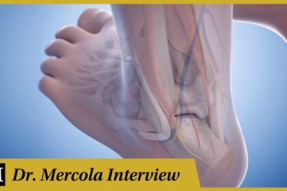Mark Sisson - Collagen for Soft Tissue Injury and Repair