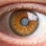 What Can You Do to Help Prevent Cataracts?