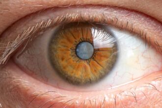 What Can You Do to Help Prevent Cataracts?