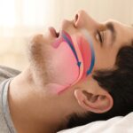 Can Snoring Be Dangerous?