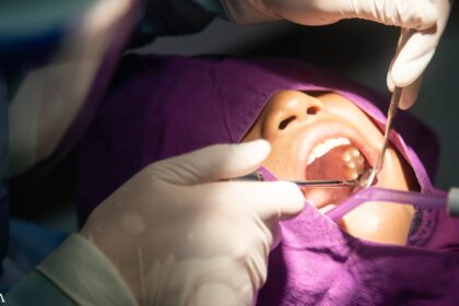 Is It Wise to Get Your Wisdom Teeth Pulled?