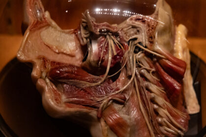 Mütter Museum in Philadelphia Weighs Dialing Down its ‘Electric Frankness’