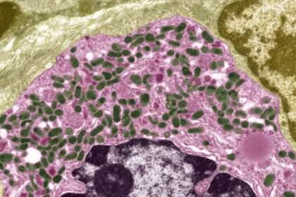 Scientists Offer a New Explanation for Long Covid