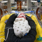 A Simple Way to Save Premature Babies