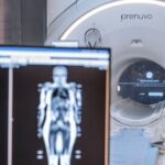 Prenuvo offers $2,500 full-body MRI scans that can detect cancer early