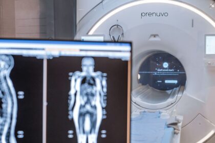 Prenuvo offers $2,500 full-body MRI scans that can detect cancer early