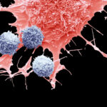 CAR-T, Lifesaving Cancer Treatment, May Sometimes Cause Cancer, FDA Says