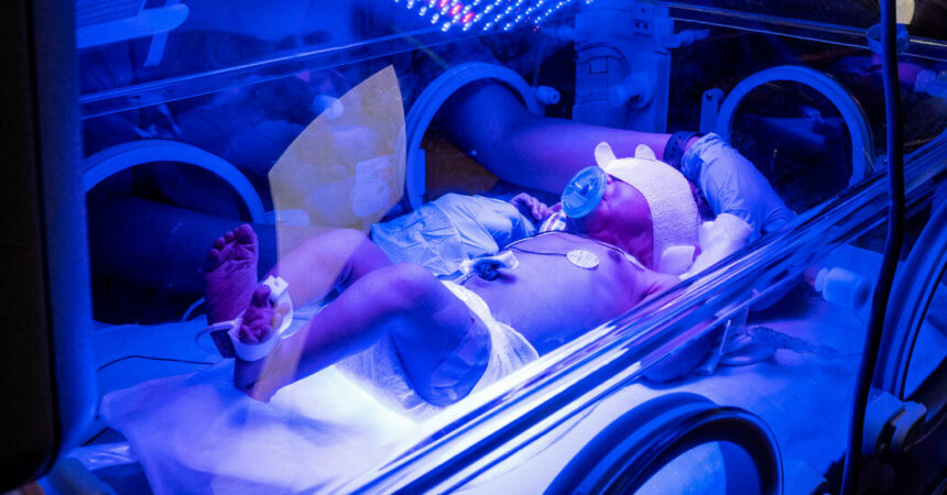 Did Your Baby Spend Time in the NICU? Tell Us About It.