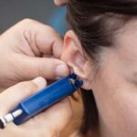 How Does Ear Piercing Change Your Skin's Microbiome?