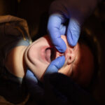 Tongue Tie Surgery: Inside the Business of Cutting Babies’ Tongues