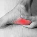 Plantar Fasciitis - Diagnosis and Natural Treatment Options