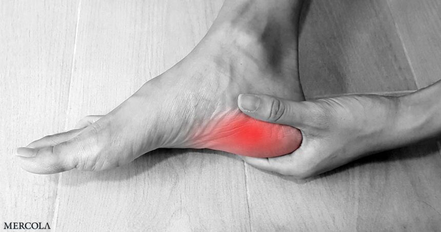 Plantar Fasciitis - Diagnosis and Natural Treatment Options