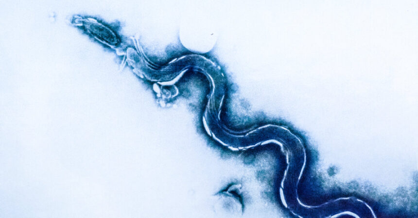 Syphilis Is Soaring in the U.S.