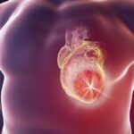 What’s the Best Predictor of Heart Disease?