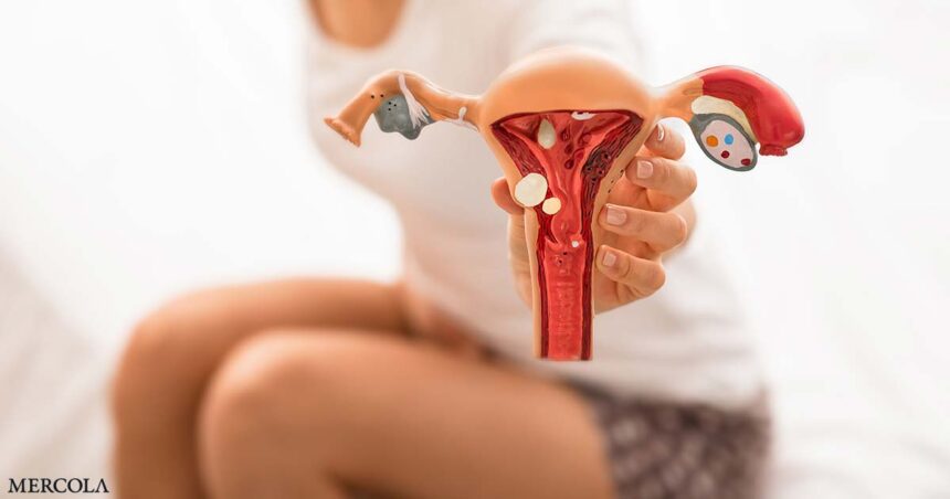 Could Endometriosis Be Caused by Bacteria?