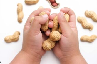 Guidelines Call for Introduction of Peanuts During Infancy to Reduce Risk of Allergy