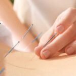 Study Reveals Previously Unknown Mechanism Behind Acupuncture's Ability to Reduce Pain