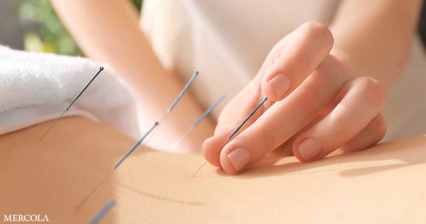 Study Reveals Previously Unknown Mechanism Behind Acupuncture's Ability to Reduce Pain