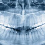 Who Knew Humans Have a Third Set of Teeth?