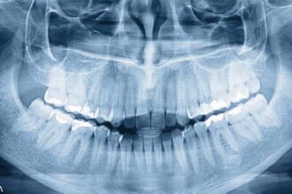 Who Knew Humans Have a Third Set of Teeth?